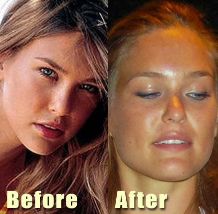 bar refaeli. Bar Refaeli before and after