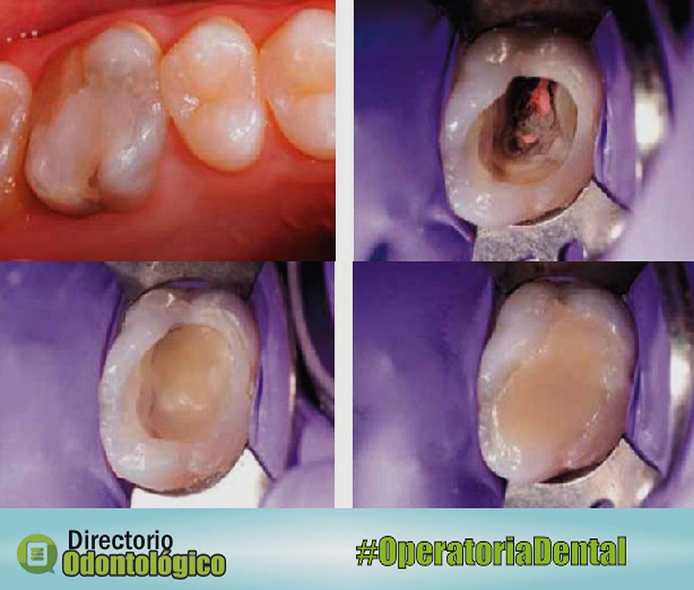 Operatoria Dental