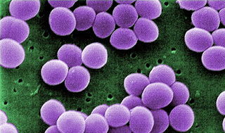 Staphylococcus Aureus.