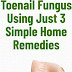 HOW TO GET RID OF TOENAIL FUNGUS USING JUST 3 SIMPLE HOME REMEDIES