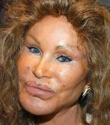 jocelyn wildenstein 2010. Jocelyn Wildenstein is a Swiss