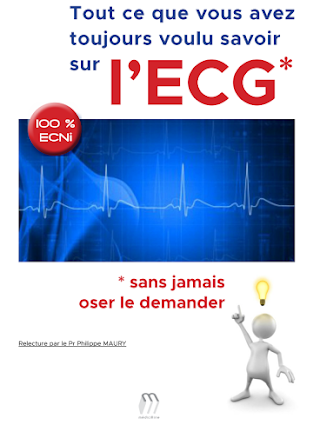 Tout ce que vous avez toujours voulu savoir sur l'ECG sans jamais oser le demander