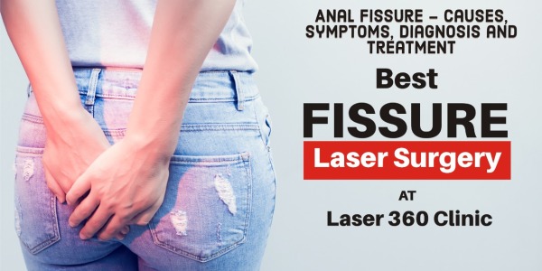 Fissure Treatment in Delhi