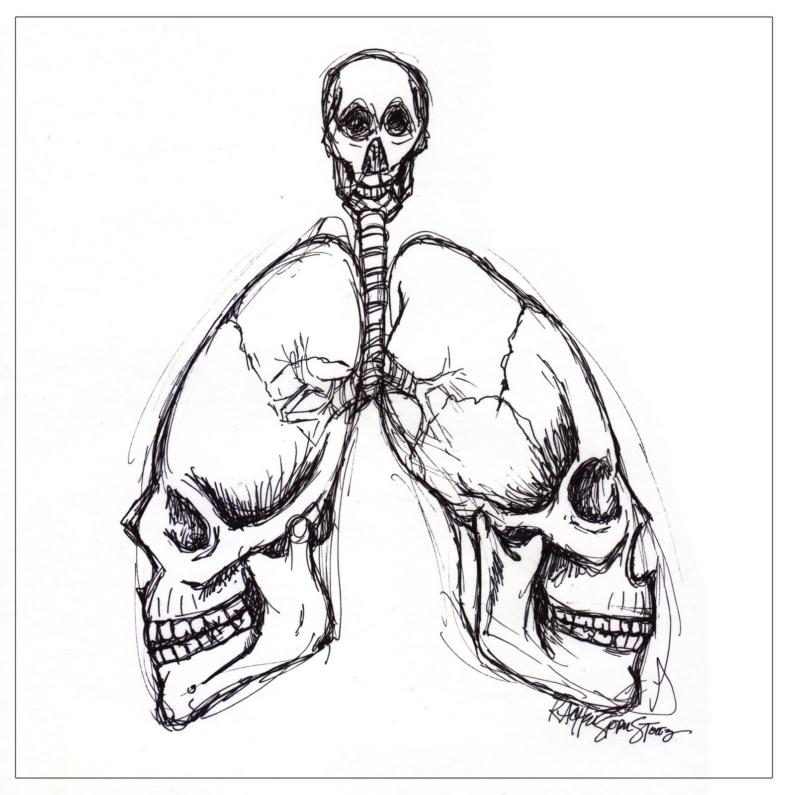 MedicalArtMofo Lungskulls A Rainy Day Doodle