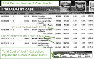 How Many Dental Implants Cost With Insurance