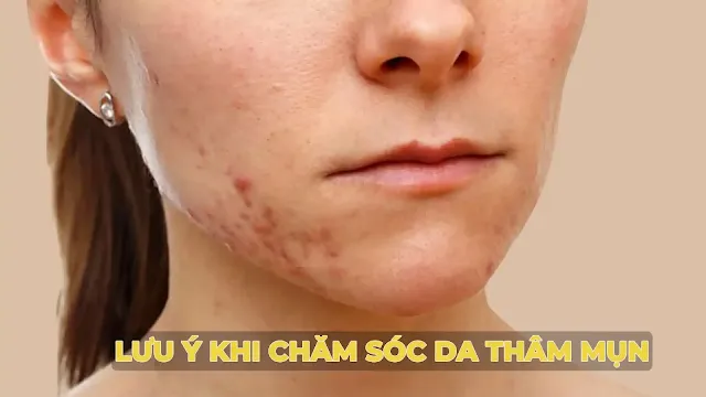 tham-mun