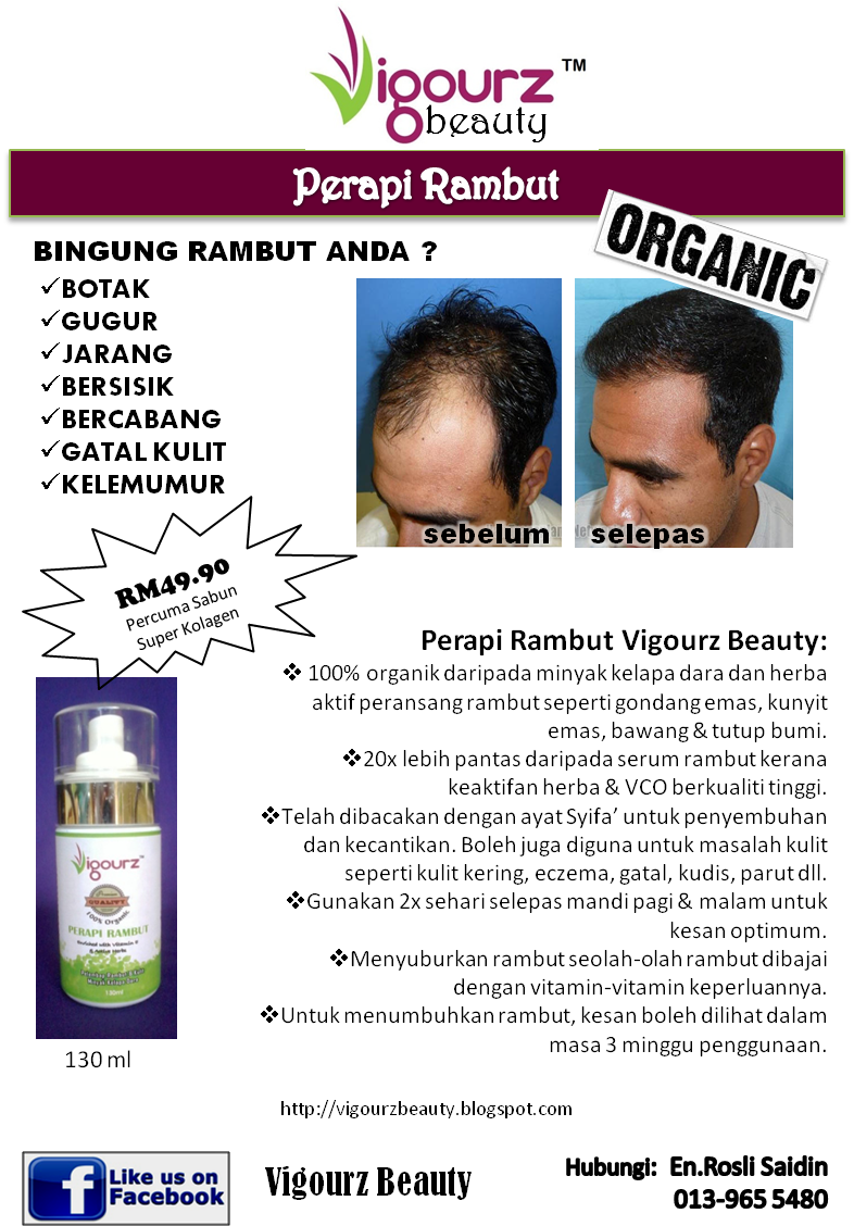 Vigourz Beauty Rawatan Rambut Gugur Dan Botak