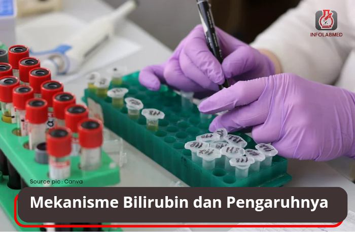 Mekanisme Pembentukan Bilirubin dan Pengaruhnya