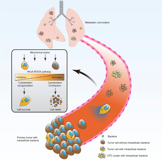 bacterias cancerosas