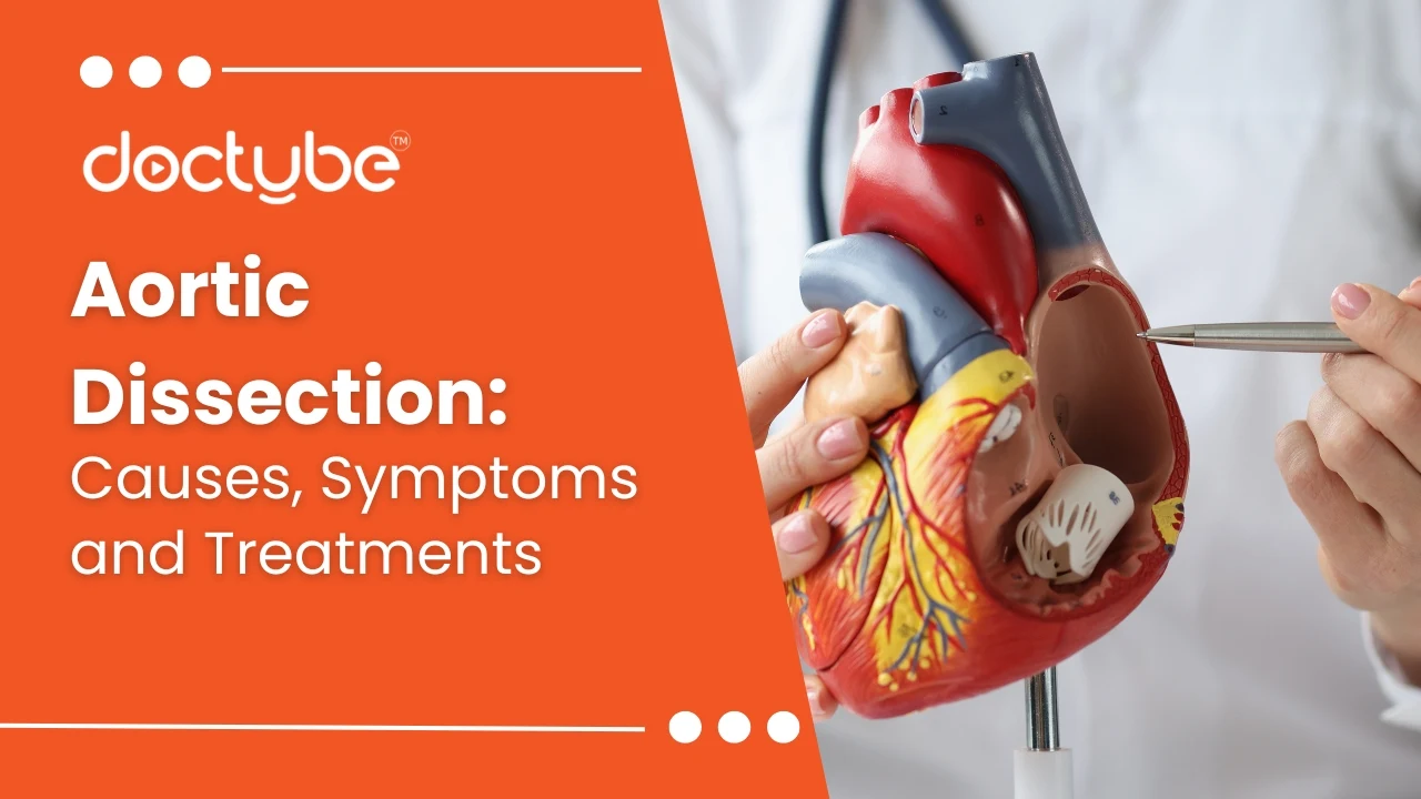 Aortic Dissection:DocTubeBlog