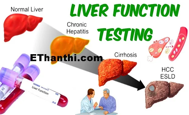 கல்லீரல் செயல்திறன் பரிசோதனை - Liver Function Test