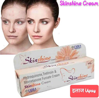 Skinshine Cream, Skinshine Cream Uses in hindi,