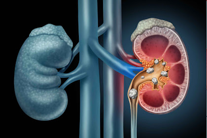 10 Signs Your Kidneys Are Not Functioning Properly