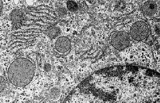 Electron micrograph of part of a eukaryote cell