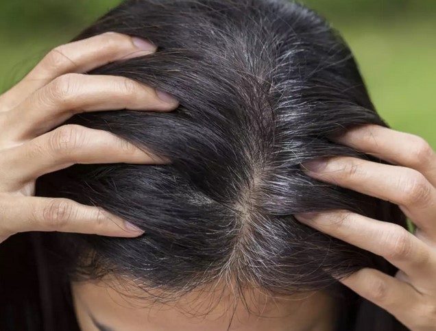 Is your hair greying prematurely ? Here are few reasons and which foods help prevent it