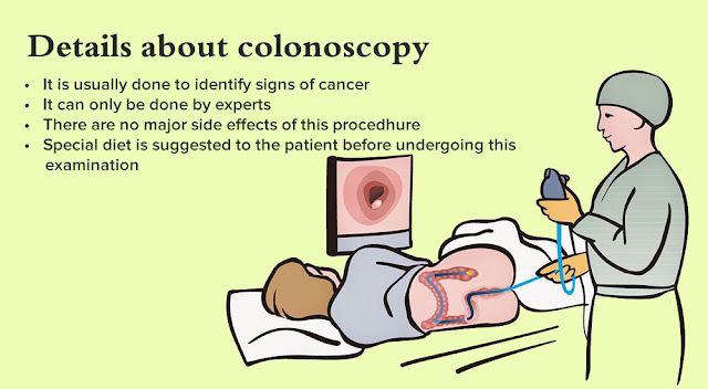 colonoscopy