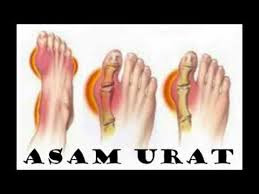 obat herbal alami buat asam urat