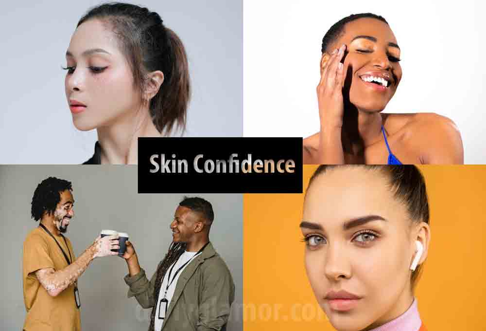 skin-confidence, it-confidence-in-your-beauty, skin-aesthetics