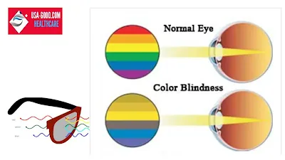What is Color Blindness?