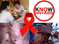 Penyebab, Cara Penularan Penyakit HIV AIDS