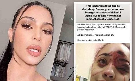 Kim Kardashian Offers To Pay Medical Bills Of Protester Hit By A Robber Bullet.