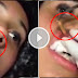 Doctors Found Shocking Parasites in a Woman's Lips! You've been warned!