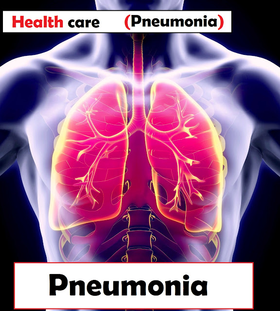 Pneumonia