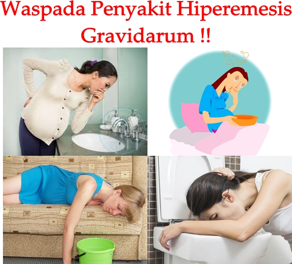 Obat Tradisional Hiperemesis Gravidarum