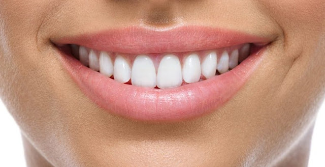 zirconium veneers dental health improve smile