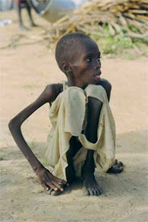 Starving child in Sudan