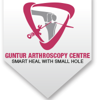 Orthopaedic doctors in Guntur - Best Orthopedic Hospitals in Guntur - Guntur Arthroscopy