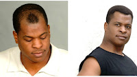 Black Male Hair Loss