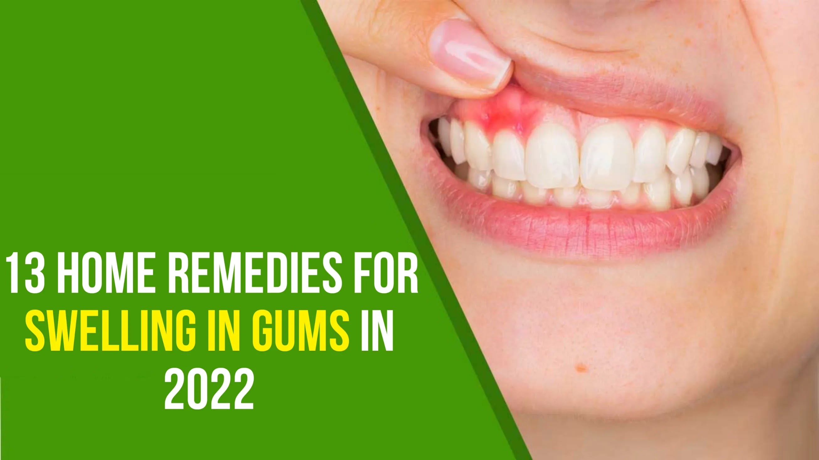 Home Remedies for Swelling in Gums in 2022