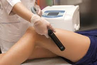 Hair removal