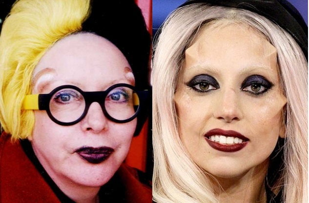 lady gaga horns. lady gaga horns surgery. lady