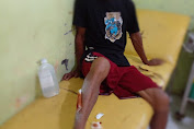 Seorang Pria Paruh Baya di Ambalawi Digigit Anjing Diduga Rabies | Taroainfo