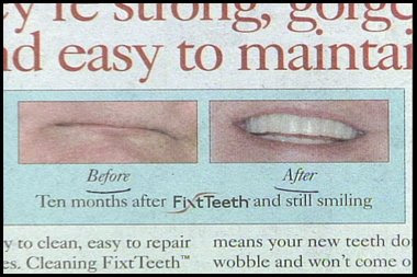 really stupid ad for dentist before and after teeth shot