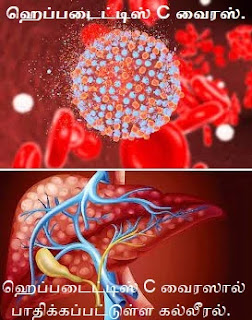 Hepatitis C virus