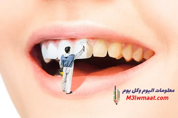 صفار الاسنان أسبابه وطرق علاجه من أول يوم , اصفرار الأسنان