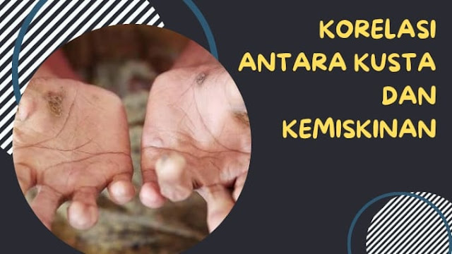 Korelasi Kusta dan Kemiskinan