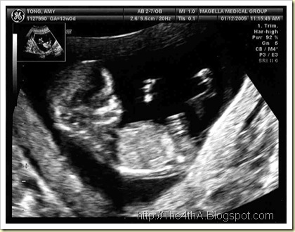 UltraSound011209Scan3