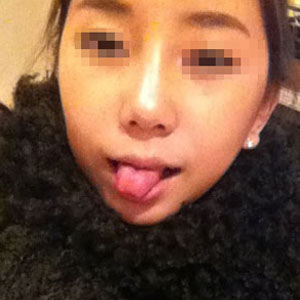 짱이뻐! - Nose And Facial Plastic Surgery Makes My Face Smaller