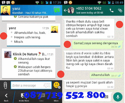 testimoni penyakit herpes