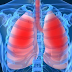 A variety of signs and symptoms of a lung infection that you know