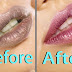How To Get Pink Lips In Just 3 Days | Get Pink Lips Fast Permanently | Changing From Black To Pink Lips