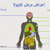 طرق مهاجمة فيروس ايبولا للجسم فيديو