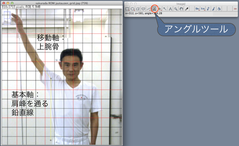 フリーソフトを用いた姿勢分析の検討 3 3 Imagejを用いた 関節可動域 角度測定