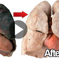 How To Purify Your Lungs Within 72 Hours!