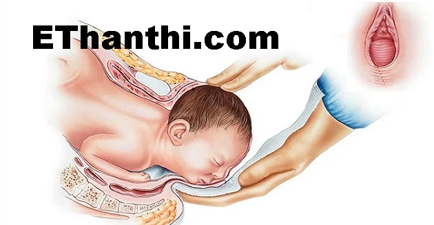 சுகப்பிரசவத்திற்குப் பின் யோனி தளர்ந்து போகுமா?