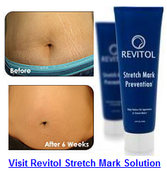 Product : Revitol Stretch Mark Prevention Cream. All Items are new set ...